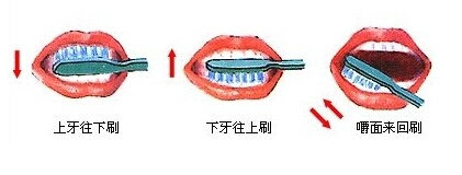 口腔护理